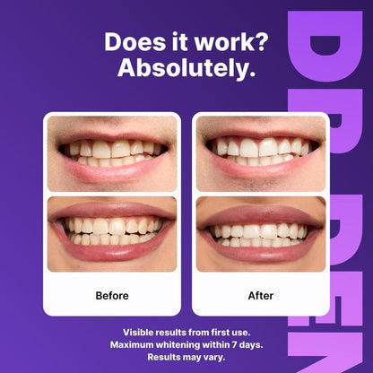 DRDENT Purple Teeth Whitening Strips